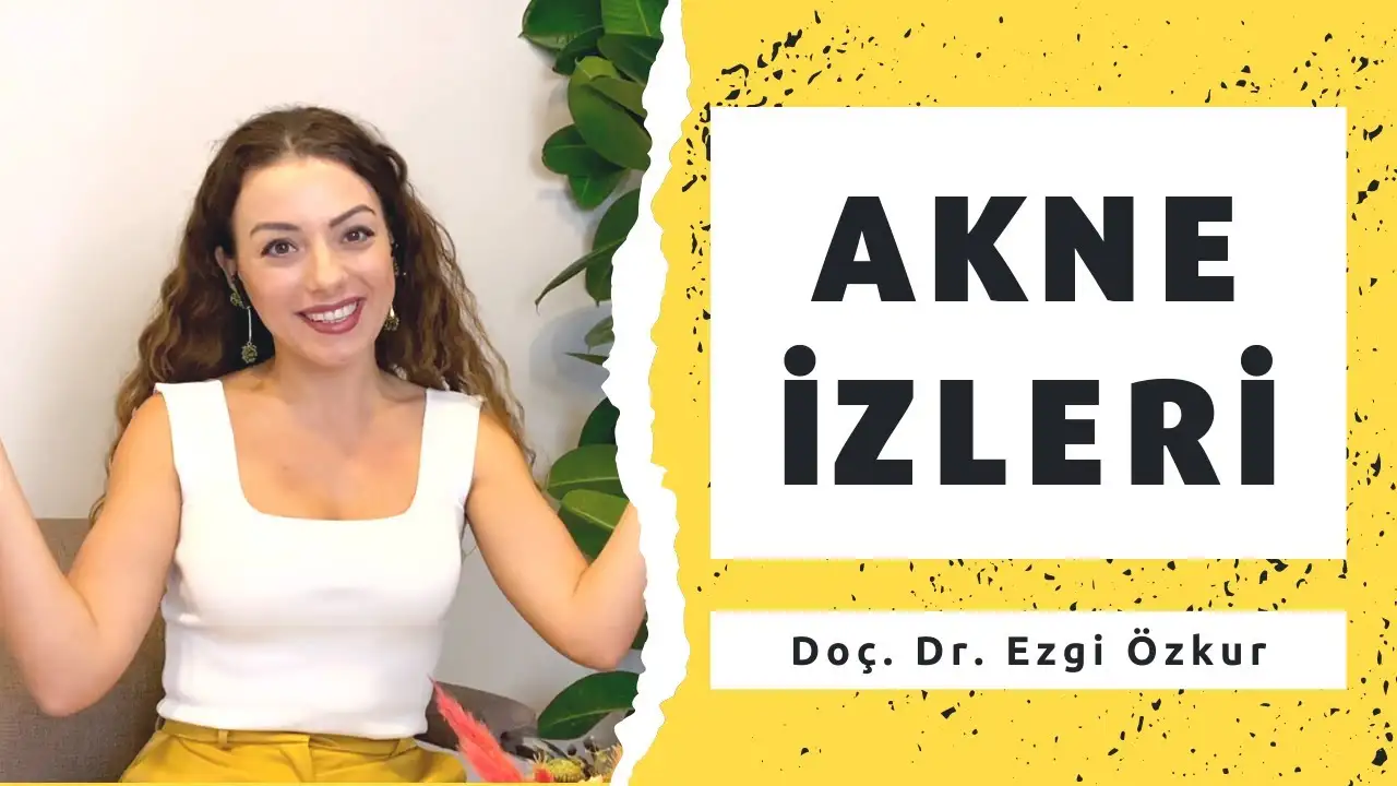 Sivilce İzleri Nasıl Geçer?