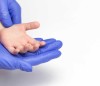 Çocuk Dermatolojisi Nedir ve Hangi Sorunları Kapsar?