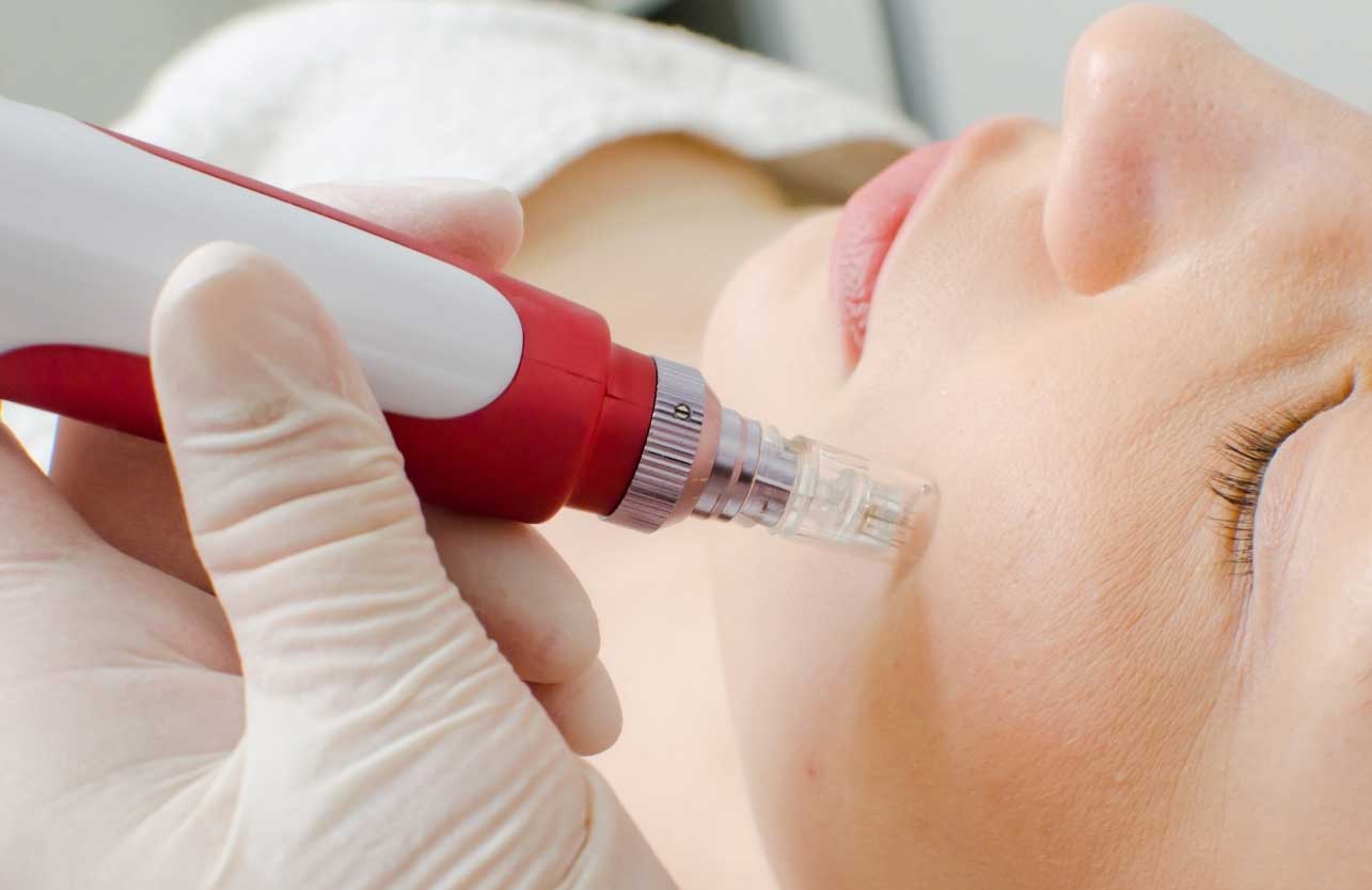 Dermapen ve Cilt Üzerindeki Etkileri