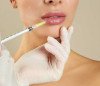 What You Need to Know Before and After Lip Fillers