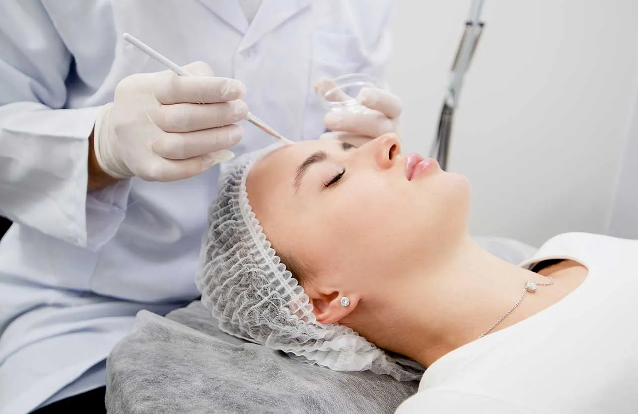 Which Skin Types Are Suitable for Chemical Peels?