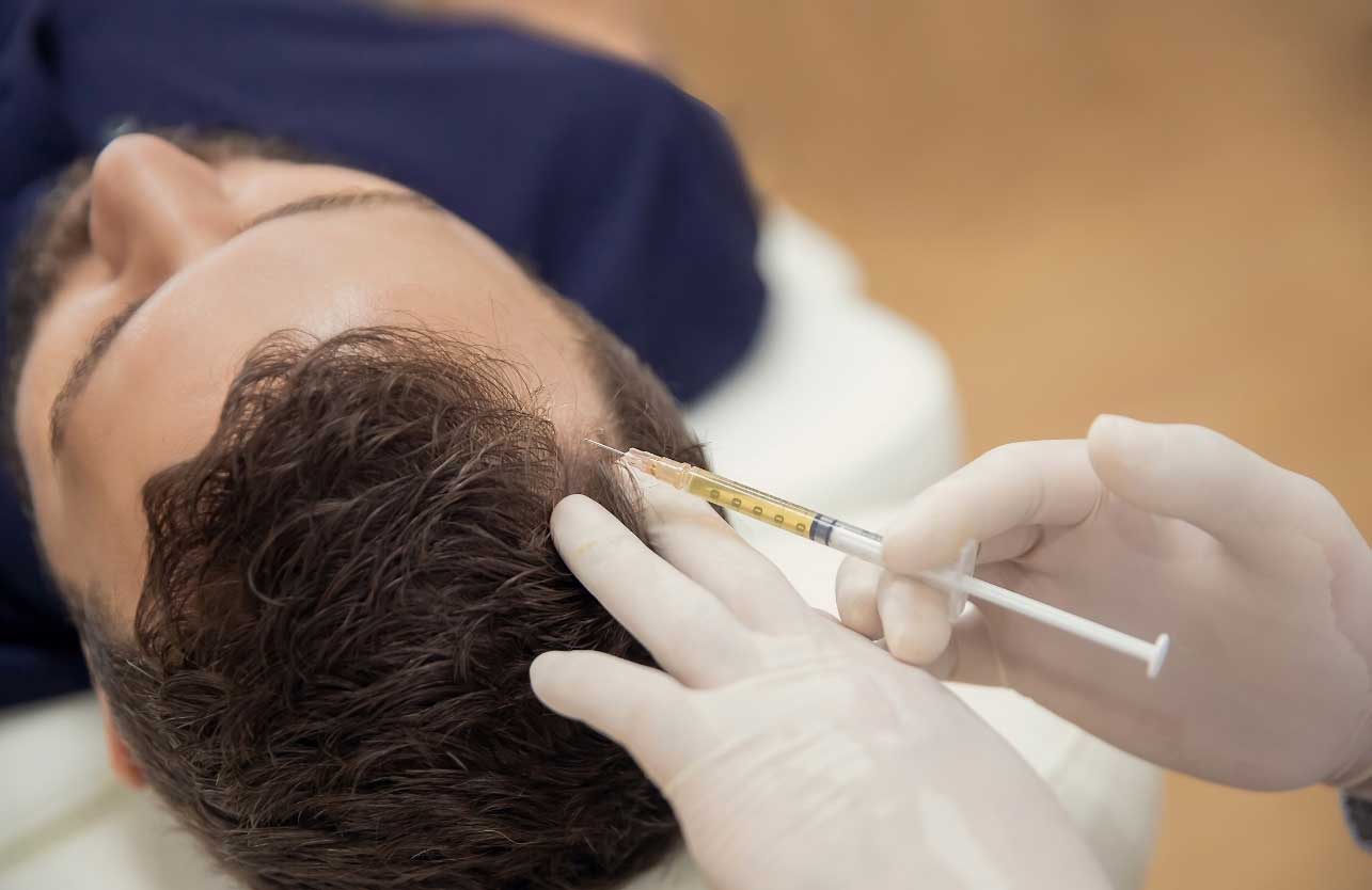 Hair Loss Treatment with Mesotherapy